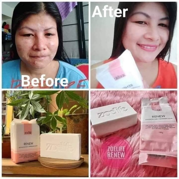 Renew Soap - Picture 3 of 6